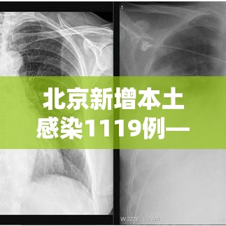 北京新增本土感染1119例—(北京新增感染病例) 北京新增本土感染1119例—(北京新增感染病例)