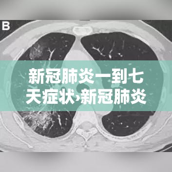 新冠肺炎一到七天症状›新冠肺炎一到七天都是什么样的症状 新冠肺炎一到七天症状›新冠肺炎一到七天都是什么样的症状