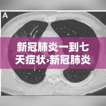新冠肺炎一到七天症状›新冠肺炎一到七天都是什么样的症状 新冠肺炎一到七天症状›新冠肺炎一到七天都是什么样的症状