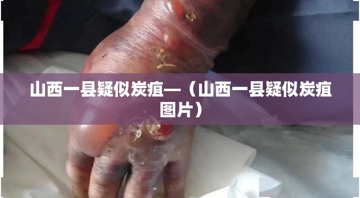 山西一县疑似炭疽—（山西一县疑似炭疽图片）