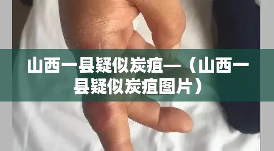 山西一县疑似炭疽—(山西一县疑似炭疽图片) 山西一县疑似炭疽—(山西一县疑似炭疽图片)