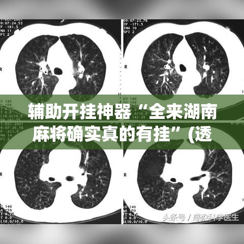 辅助开挂神器“全来湖南麻将确实真的有挂	”(透视挂)辅助透视教程