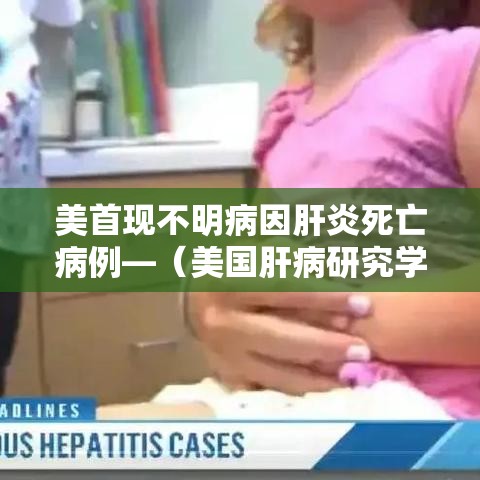 美首现不明病因肝炎死亡病例—（美国肝病研究学会）