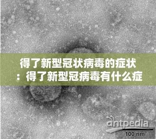 得了新型冠状病毒的症状:得了新型冠病毒有什么症状 得了新型冠状病毒的症状:得了新型冠病毒有什么症状