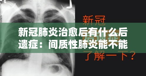 新冠肺炎治愈后有什么后遗症:间质性肺炎能不能治好 新冠肺炎治愈后有什么后遗症:间质性肺炎能不能治好